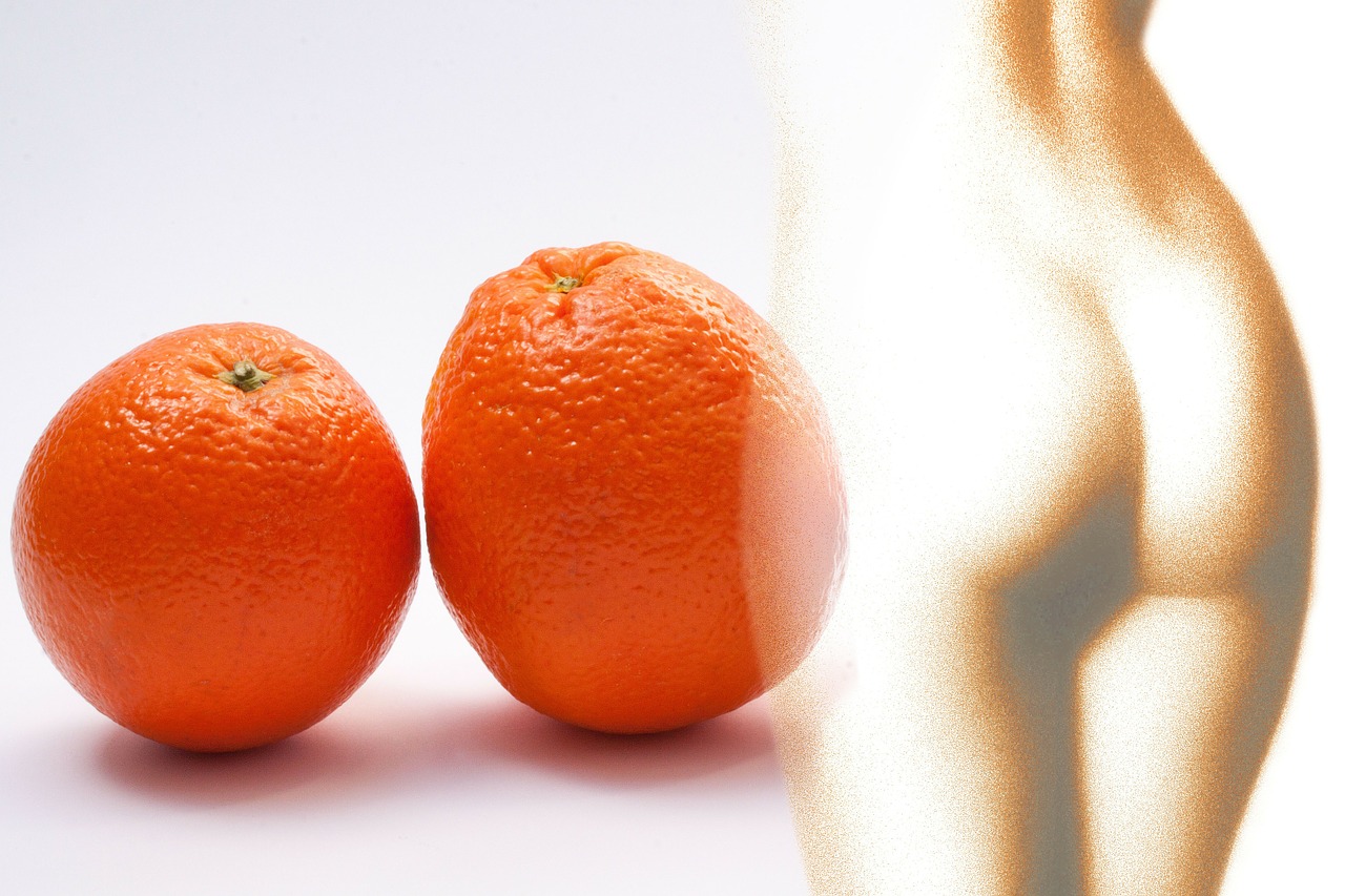 orangenhaut cellulite