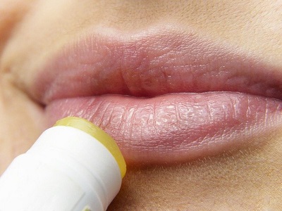 Herpes und Lippenherpes